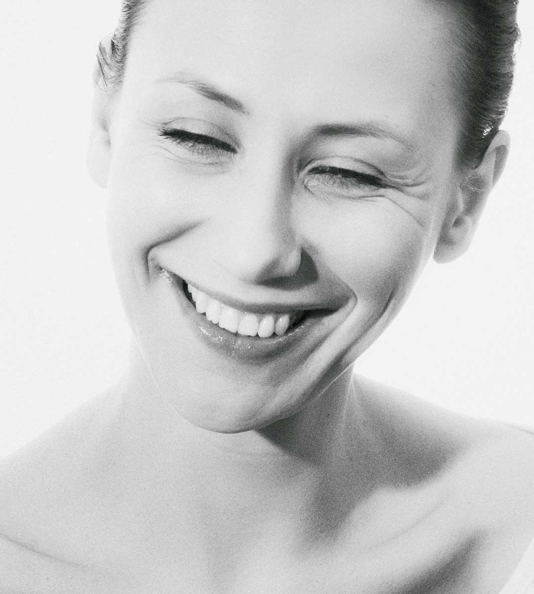 Después blanqueamiento